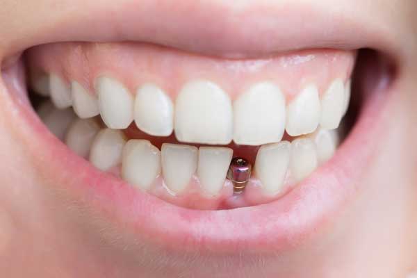 همه چیز در مورد دندان پزشکی