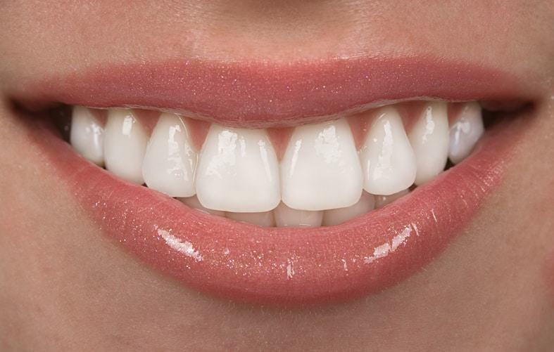 فواید استفاده از کامپوزیت دندان های جلو 
