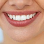 فواید استفاده از کامپوزیت دندان های جلو