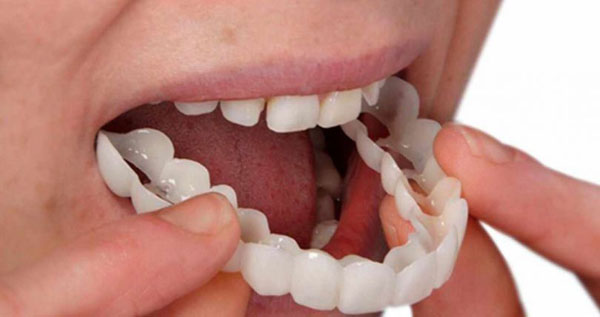 مهم ترین اقدامات متخصص زیبایی دندان 