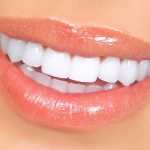 رژیم غذایی بعد از کامپوزیت دندان