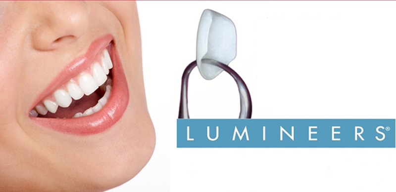 لومینیرز دندان و تفاوت آن با لمینت