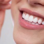 قیمت کامپوزیت دندان