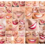 کامپوزیت دندان طبیعی تر است یا لمینت دندان؟