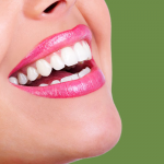 مزایا و کاربرد لمینت ای پی اس