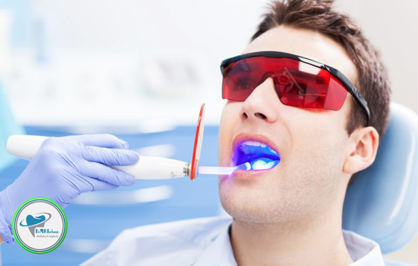لمینت دندان چه تفاوتی با ارتودنسی با لیزر دارد؟ 