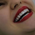 روشهای مراقبت از لمینت دندان