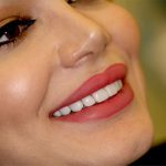 مراقبت های بعد از لمینت دندان
