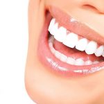 تفاوت لمینت سرامیکی و کامپوزیتی در چیست؟