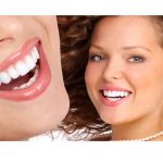 مراحل استفاده از لمینت های سرامیکی