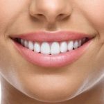 لمینت سرامیکی چه مشکلاتی را برطرف میکنند؟