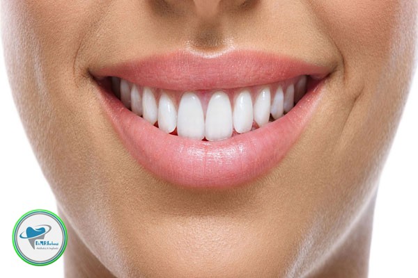 کامپوزیت دندان به روش لیرینگ 