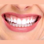کامپوزیت دندان به روش لیرینگ