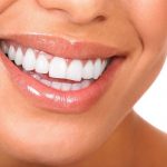 تفاوت لمینت فلدسپاتیک و آی پی اس