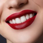 آیا می توان دندان روکش شده را کامپوزیت کرد؟
