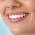 آیا لمینت دندان باعث بوی بد دهان می شود؟