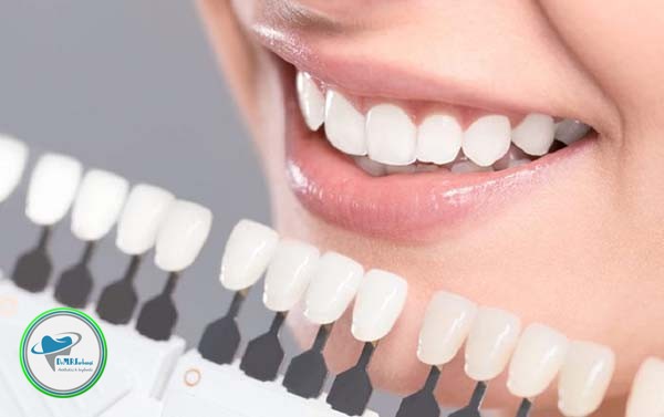 کامپوزیت دندان و بلیچینگ چه تفاوتی دارند؟ 