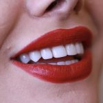 آیا کامپوزیت برای دندان مضر است؟